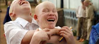 Image of children with albinism hugging.