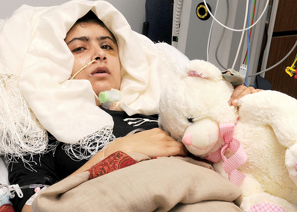 This image shows Malala Yousafzai laying on the bed in an hospital in UK after coming out of coma. But, her half of the face is still paralyzed. 